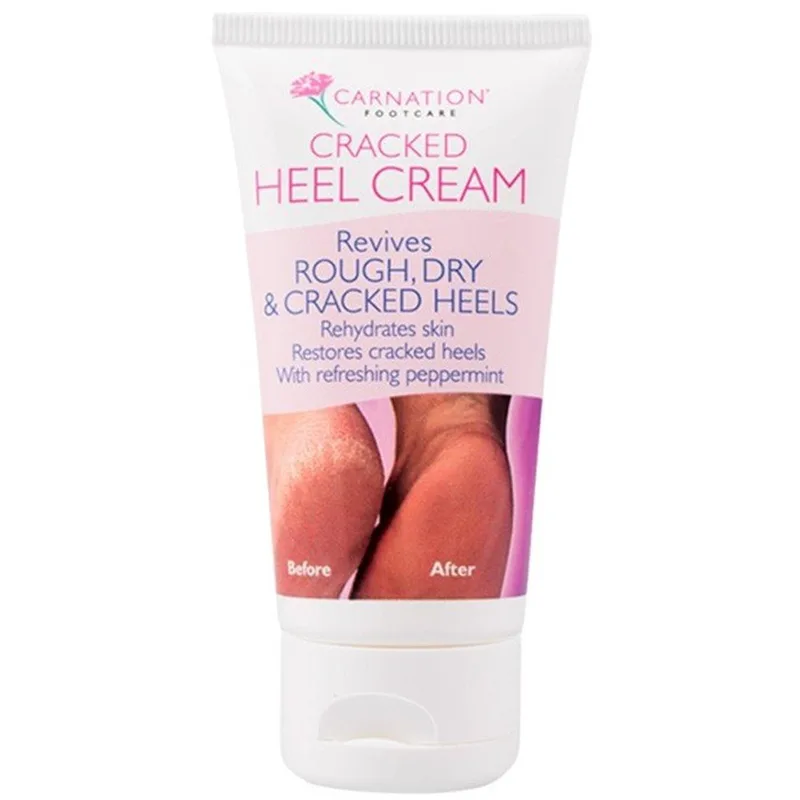 Carnation Footcare Cracked Heel Cream Κρέμα Αναζωογόνησης για Άγριες, Ξηρές & Ταλαιπωρημένες Πτέρνες με Έλαιο Μέντας 50ml